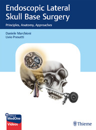 Endoscopic Lateral Skull Base Surgery: Principles, Anatomy, Approaches PDF & video