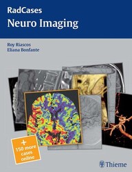 Radcases Neuro Imaging (Radcases Plus Q&A) 1st Edition PDF