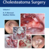 Atlas of Cavityless Cholesteatoma Surgery PDF