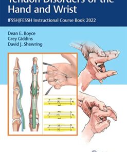 Tendon Disorders of the Hand and Wrist: IFSSH/FESSH Instructional Course Book 2022 PDF