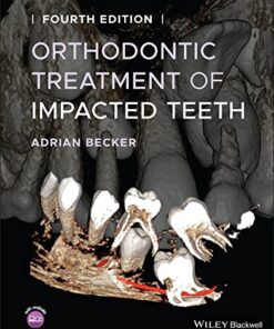 Orthodontic Treatment of Impacted Teeth 4th Edition PDF