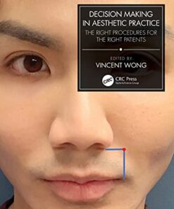 Decision Making in Aesthetic Practice: The Right Procedures for the Right Patients 1st Edition PDF