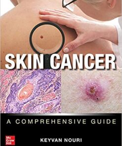 Skin Cancer: A Comprehensive Guide 1st Edition PDF Original