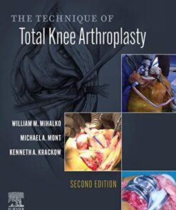 The Technique of Total Knee Arthroplasty 2nd Edition PDF Original