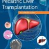 Pediatric Liver Transplantation: A Clinical Guide 1st Edition PDF Original