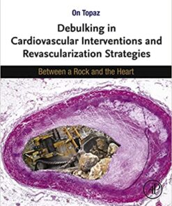 Debulking in Cardiovascular Interventions and Revascularization Strategies: Between a Rock and the Heart (Original PDF from Publisher)