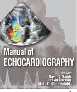 Manual of Echocardiography, 2nd Edition (Original PDF from Publisher)