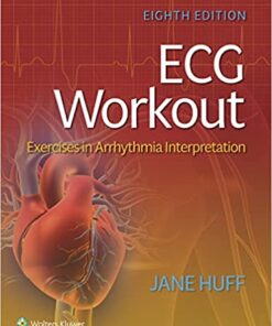 ECG Workout: Exercises in Arrhythmia Interpretation, 8th Edition (EPUB + Converted PDF)