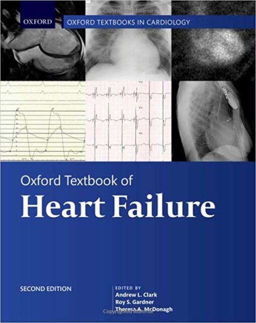 Oxford Textbook of Heart Failure, 2nd Edition (Oxford Textbooks in Cardiology) (Original PDF from Publisher)