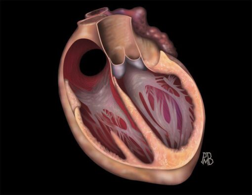 MRIOnline Mastery Series: Fundamentals of Cardiac MRI 2021 (CME VIDEOS)