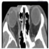 Imaging Victims of Violence Fists, Stabs, Bullets, and Blasts 2021 (CME VIDEOS)