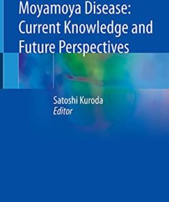 Moyamoya Disease: Current Knowledge and Future Perspectives 1st ed. 2021 Edition PDF Original