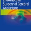 Endovascular Surgery of Cerebral Aneurysms 1st ed. 2022 Edition PDF Original