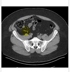 MRIOnline Imaging Mastery Series: Appendix 2021 (CME VIDEOS)