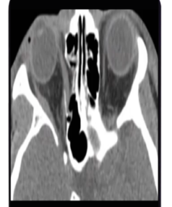 ARRS Imaging Victims of Violence: Fists, Stabs, Bullets, and Blasts 2021 (CME VIDEOS)