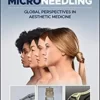 Microneedling: Global Perspectives in Aesthetic Medicine (Original PDF from Publisher)