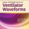 Rapid Interpretation of Ventilator Waveforms, 3rd Edition (EPUB)