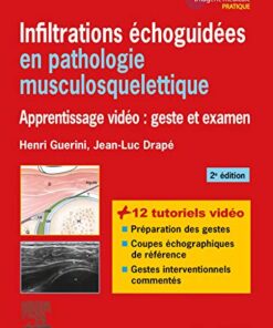 Infiltrations échoguidées en pathologie musculosquelettique: Apprentissage vidéo : geste et examen (Imagerie médicale : pratique) (French Edition) (Original PDF from Publisher)