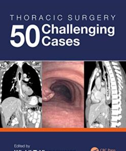 Thoracic Surgery: 50 Challenging cases (Original PDF from Publisher)