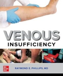 Venous Insufficiency (EPUB)