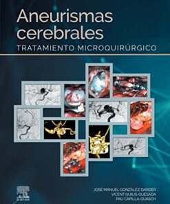 Aneurismas cerebrales: Tratamiento microquirúrgico (Original PDF from Publisher)