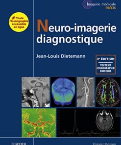 Neuro-imagerie diagnostique, 3e (Original PDF from Publisher)