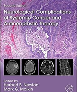 Neurological Complications of Systemic Cancer and Antineoplastic Therapy, 2nd Edition (Original PDF from Publisher)