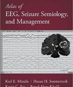 Atlas of EEG, Seizure Semiology, and Management, 3rd Edition (Original PDF from Publisher)