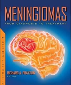 Meningiomas: From Diagnosis to Treatment (Original PDF From Publisher)