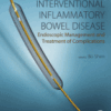 Interventional Inflammatory Bowel Disease: Endoscopic Management and Treatment of Complications