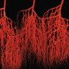 Regenerative Medicine for Peripheral Artery Disease