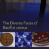 The Diverse Faces of Bacillus cereus