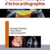 Guide Pratique D'échocardiographie