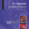 La Colposcopie Technique et Diagnostics