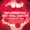 Inflammation and Oral Cancer From Bench to Bedside