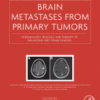 Brain Metastases from Primary Tumors, Volume 3 Epidemiology, Biology, and Therapy of Melanoma and Other Cancers