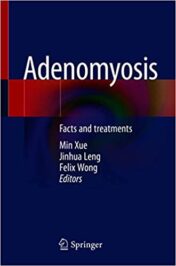 Adenomyosis: Facts and treatments (Original PDF)
