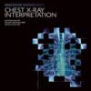 Discover Radiology: Chest X-Ray Interpretation 1st Ed