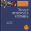 Chirurgie endoscopique endonasale