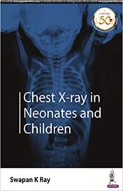 Chest X-Ray in Neonates and Children original pdf