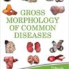 Gross Morphology of Common Diseases