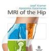 MRI of the Hip