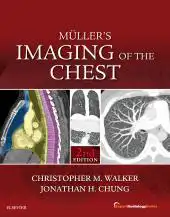 Muller's Imaging of the Chest E-Book : Expert Radiology Series (Original PDF) 2018
