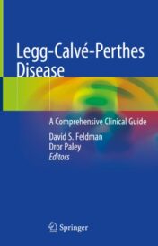 Legg-Calvé-Perthes Disease A Comprehensive Clinical Guide 2020 ORIGINAL PDF