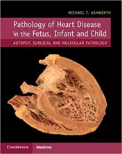 Pathology of Heart Disease in the Fetus, Infant and Child (PDF)