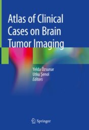 Atlas of Clinical Cases on Brain Tumor Imaging 2020 original pdf
