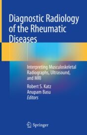 Diagnostic Radiology of the Rheumatic Diseases Interpreting Musculoskeletal Radiographs, Ultrasound, and MRI 2020 ORIGINAL PDF