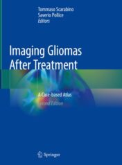 Imaging Gliomas After Treatment A Case-based Atlas 2020 ORIGINAL PDF
