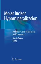 Molar Incisor Hypomineralization A Clinical Guide to Diagnosis and Treatment 2020 ORIGINAL PDF