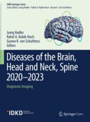 Diseases of the Brain, Head and Neck, Spine 2020–2023 Diagnostic Imaging 2020 ORIGINAL PDF